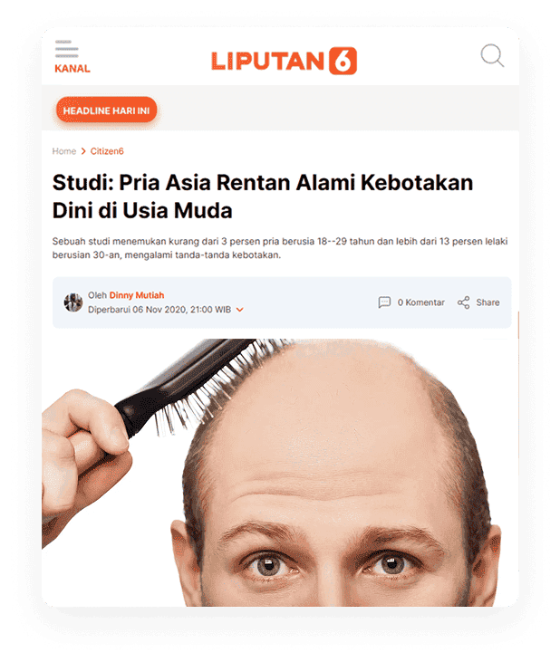 Berita kebotakan pria